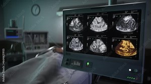 Scanner With Multiple Screens Showing Baby For Health Examination Procedure. Scanning Condition Of Baby. Prenatal Analysis Procedure. Hospital Scanner. Baby Screening. Pregnancy Diagnostic Procedure