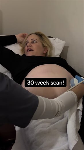 It’s my 30-week scan day! Of course there is a polar vortex in Toronto lol! So we trudged our way through the snow to get to my appointment. 🤍 I had to eat something sugary before it, to get him moving around, so I had some cherry blasters! 🍒 He’s thriving, happy in there, and we got to see him practice breathing…basically rehearsing for his big day! Lol! 🥹 Awww! ❤️🥰 We grabbed a sonogram pic and asked ChatGPT to turn it into what he might look like as a baby using his measurements and photo