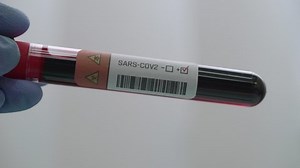 「コロナウイルス感染、医療に対する陽性のPCRテストを持つ研究員手」の動画素材（ロイヤリティフリー）1054058261 | Shutterstock