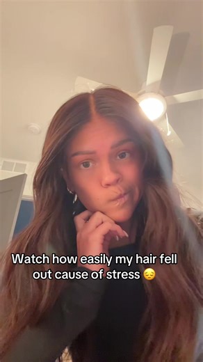 Really hard time right now guys 😔 #fyp #stressed #hairloss #sad #cry | hair falling out