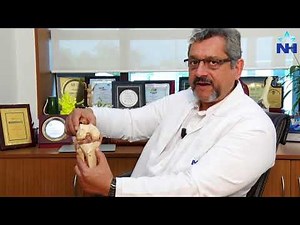 ACL Reconstruction Surgery: Procedure and Recovery Explained