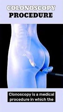 Colonoscopy Procedure Explained in 3D! From Prep to Polyp Removal #facts