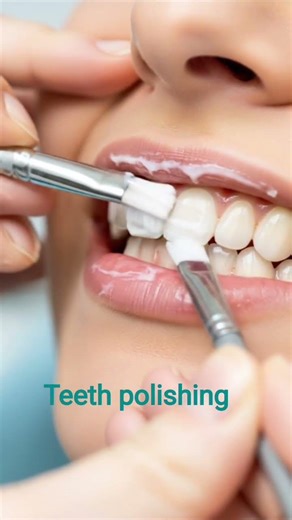 How teeth polishing procedure #shortsfeed #dentist #cosmeticdentistry #shortvideo #orthodontist