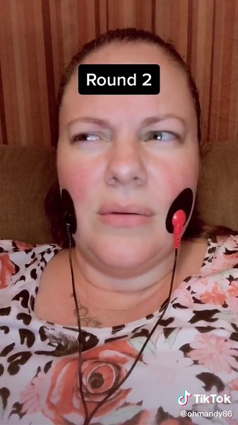 Weird Face Sensation: TENS Unit Challenge Results