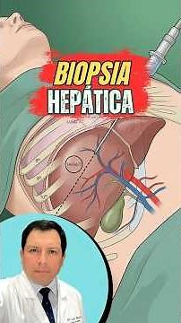 Liver biopsy? What does it involve? #liver