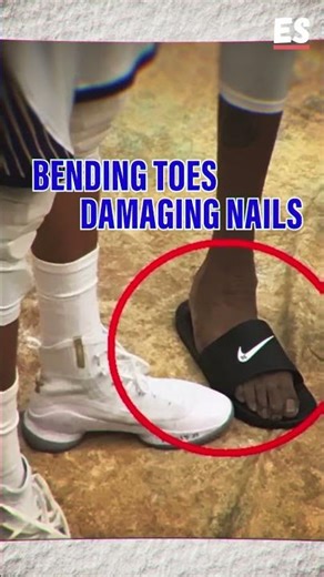 Why Do NBA Players Have Weird Feet?