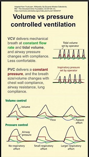 Volume vs pressure controlled ventilation