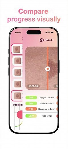 SkinAI – AI-Powered Skin Scanner & Tracker