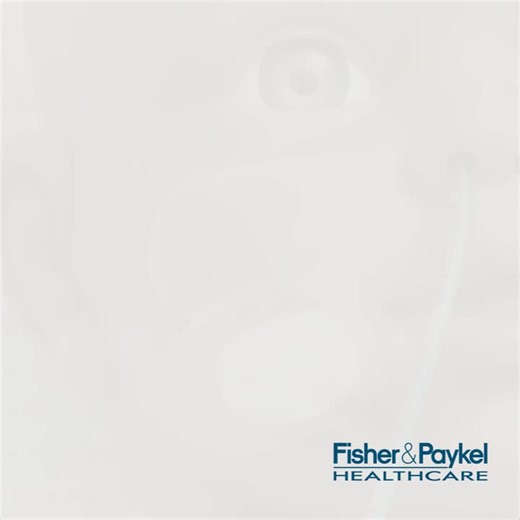 WigglewiNG™ can be used in conjunction with the F&P Optiflow™ Junior 2 nasal high flow interface to stabilize a nasogastric (NG) tube to the patient, while maintaining the ability to remove or… | Fisher & Paykel Healthcare | 22 comments