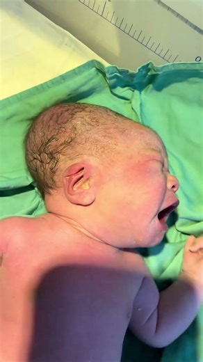 Changing Baby Position with a Peanut Ball Leads to Natural Birth #BirthStory