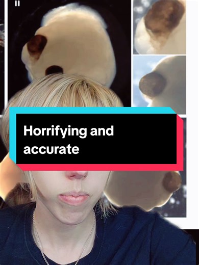 Understanding Humanity Through Brain Organoids