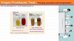 Voges Proskauer Test | Lab Tests Guide