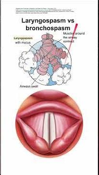 Laryngospasm vs bronchospasm
