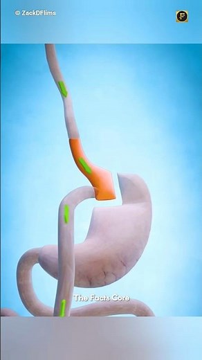 How Humans Live Without a Stomach ?