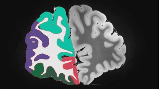 Brain atlas reveals genetic risks for cancer and mental illness