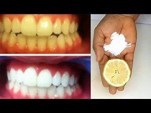 EASILY REMOVE DENTAL PLAQUE AT HOME IN 2 MINUTES WITHOUT WASTING YOUR MONEY AT THE DENTIST
