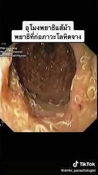 Intestinal whipworms