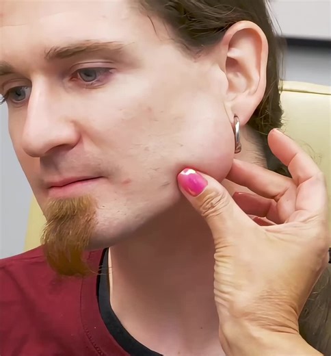 Satisfying Moments from Dr. Pimple Popper: Before and After