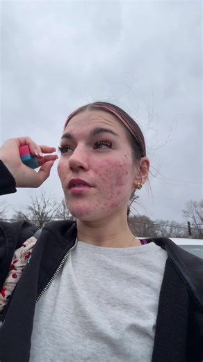 Root Canal Experience: What You Need to Know