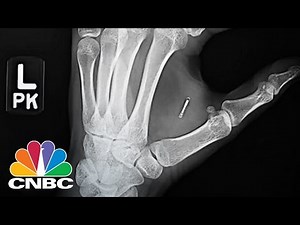 Buzzfeed Reporter Implants Payments Chip In Hand | CNBC