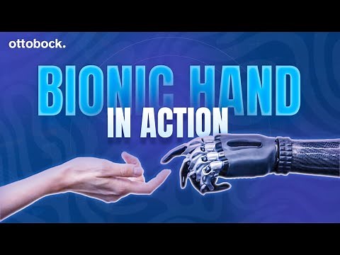 How the bebionic Multi Articulating Hand Works | Grip Patterns Demo
