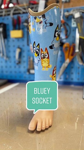 Haven’t done a fabric finish in a while so this was a fun little socket to work on 😍 #prosthetictechnician #prosthetics #prosthetiktok #prostech #prostheticsocket #prostheticleg #bluey