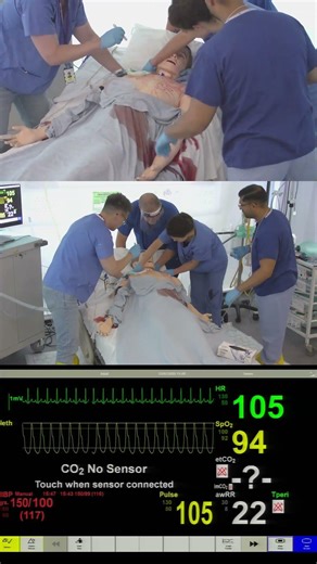 ENT Simulation – Major Haemorrhage from Tracheostomy Emergency