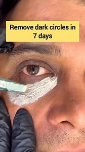 Bye Bye Dark Circles ✨ | Natural Under Eye Cream With Turmeric powder & Vaseline . . . #darkcircles #darkundereye #ridofdarkcircles #ridofdarkundereyes #skincareroutine #reelsvideoシ #reelsfypシ #reelsfbシ #fbreelsfypシ゚ #reelschallenge #explorepage | Back to nature remedy