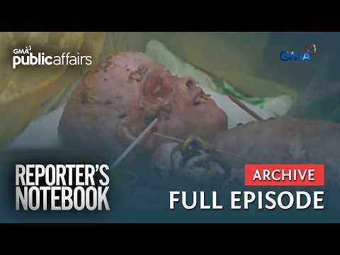 21-anyos na lalaki, unti-unting naaagnas ang katawan? (Full Episode) | Reporter’s Notebook