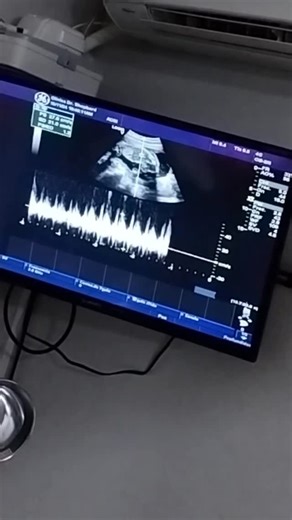 Lynda Zamora | Me tomo mucho tiempo volver, tenía mucho miedo de mi misma, quería disfrutar mi proceso sin compararme con la vida perfecta de redes... | Instagram