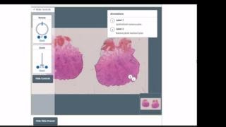 As we celebrate the 2-year anniversary of the Pathology Portal, do join us and explore! Discover whole slide images and long cases, to specialist pathology content not available anywhere else! Sign up now to help improve your professional practice: https://www.rcpath.org/profession/pathology-portal.html | The Royal College of Pathologists | Facebook
