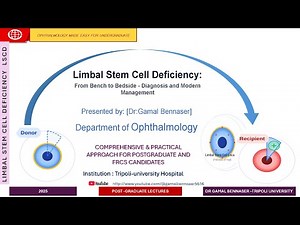 LIMBAL STEM CELL DEFICIENCY LSCD