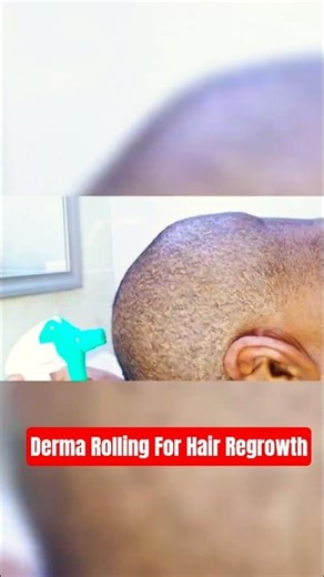 Can Derma Rolling Work Alone