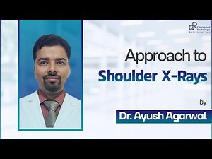 Approach to Shoulder X rays by Dr.Ayush Agarwal | Conceptual Radiology | Radiology Residency