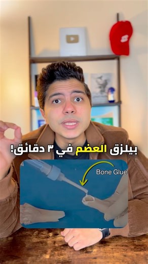 Andrew Samir on Instagram‎: "وداعا للجبس و الشرائح و المسامير! الصين عملت صمغ بيلزق العضم!"‎