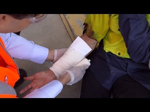 Treating Burns Safety Training Video Preview - Safetycare