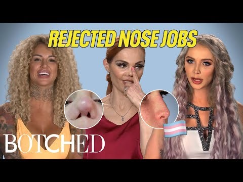 Dr. Nassif Rejected These Nose Jobs: Gender Transition, Freak Accidents and More! | Botched | E!