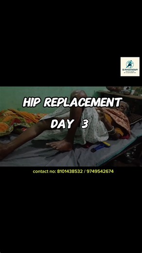 Hip Replacement ( Day 3) #physiotherapy #physiotherapist #ytshorts