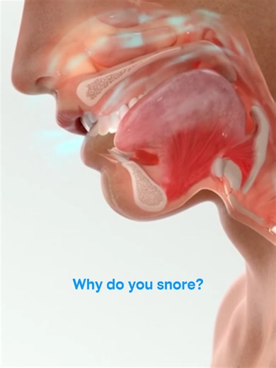 Did you know this is what causes snoring? 🤯#snoring #snore #antisnore #willnice