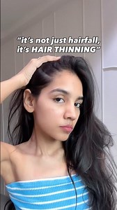 HAIR THINNING ON SCALP‼️ check description #hairthinning #thinhair #hairfall #hairloss #thinhairtips