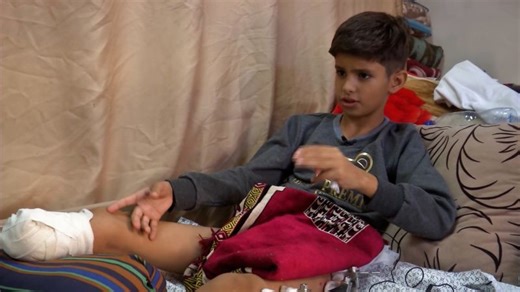 Children without limbs, children without parents: Jomana Karadsheh visits Gaza's wounded kids