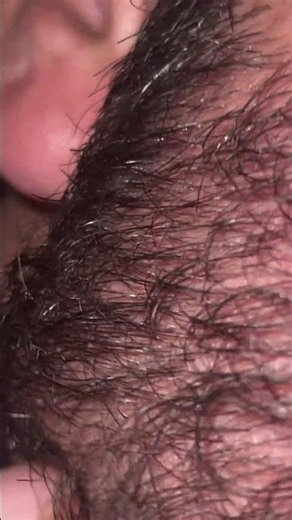 #blackheadcaique #pimple #oddlysatisfying #thebarbersarms #blackheads #satisfying #relax #skincare