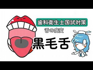 黒毛舌【歯科衛生士国試対策】