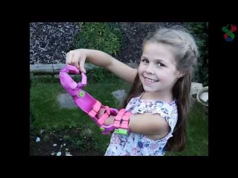 The Unlimbited arm (Isabella Edition)