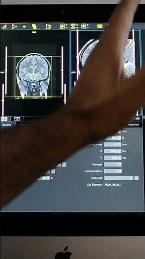 How to run pituitary Dynamic sequences in mri