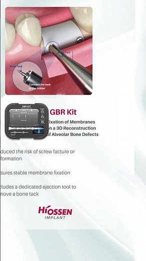GBR Kits