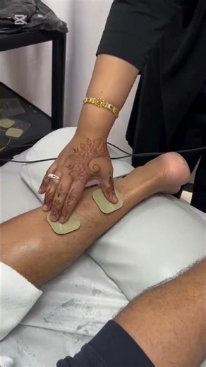 IFC Treatment Benefits part 1 Physiotherapy First Brampton