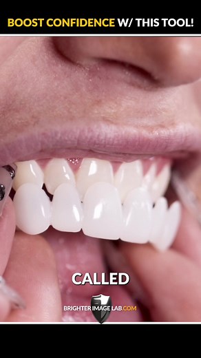 How do you want the world to remember you? Flash them your brightest and most beautiful smile with Bil Vneers! #brighterimagelab #firstimpression #smilemakeover #smile #smilemore #confidence #dentalveneers #veneers