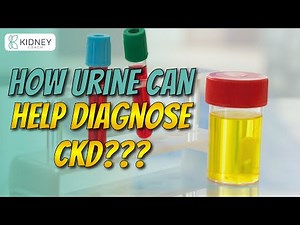 Urine Test To Diagnose Chronic Kidney Disease CKD | Urinalysis