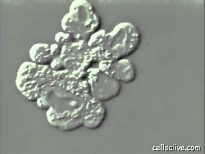 Apoptosis - Programmed cell death